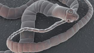 Anzeichen von Würmern