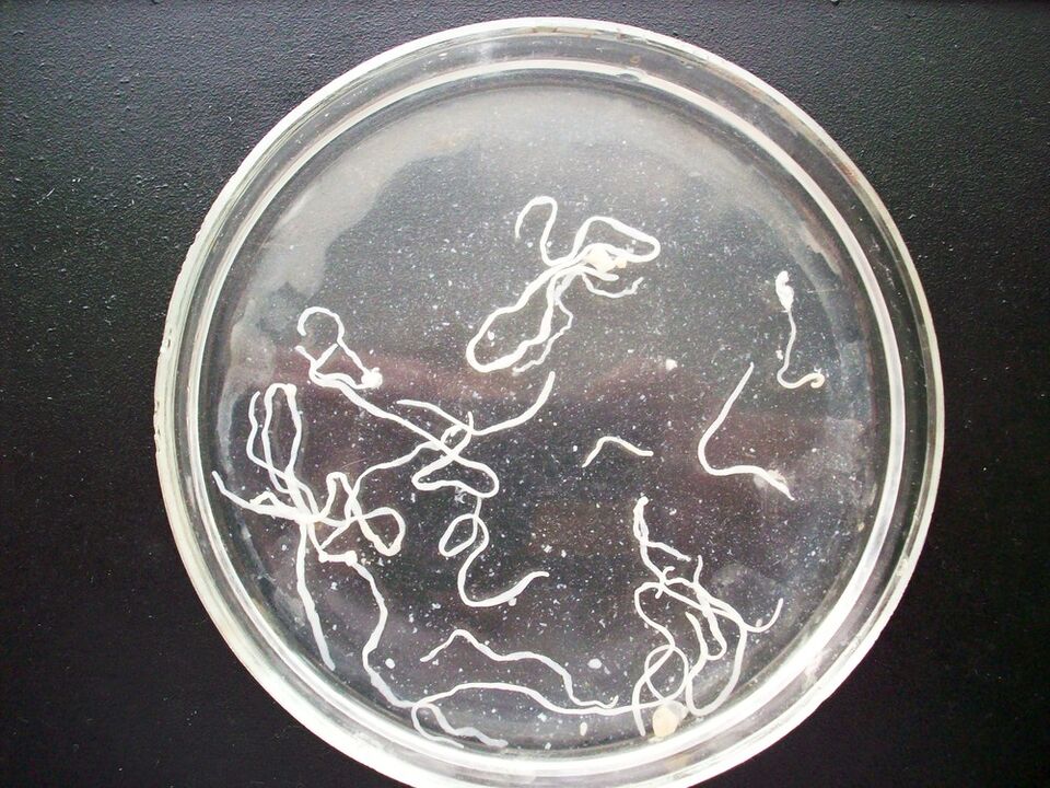 wie Darmwürmer aussehen
