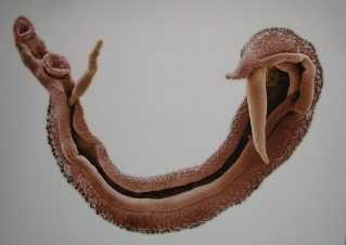 Symptome von worms ZNS